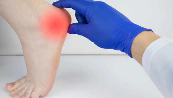 Боли в ногах при ортопедических патологиях