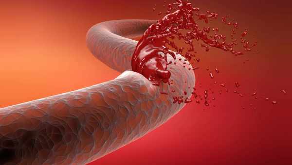 Почему сворачивается наша кровь: система гемостаза и ее «опции»